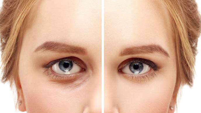 معرفی روش‌های جوانسازی چشم