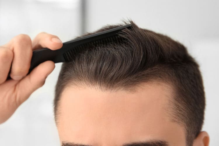 درصد موفقیت کاشت مو به روش Fut