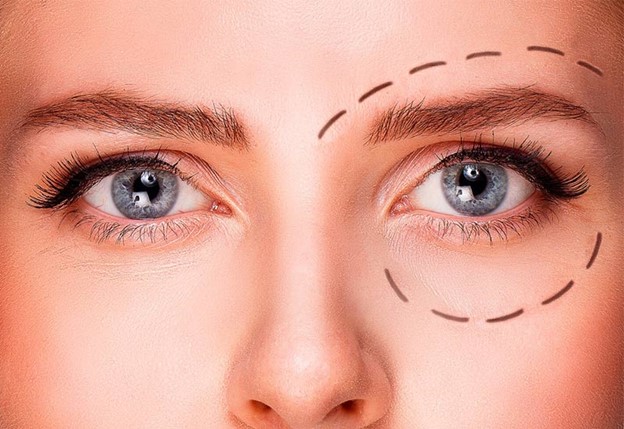 علت کوچک شدن چشم بعد از عمل بلفاروپلاستی چیست